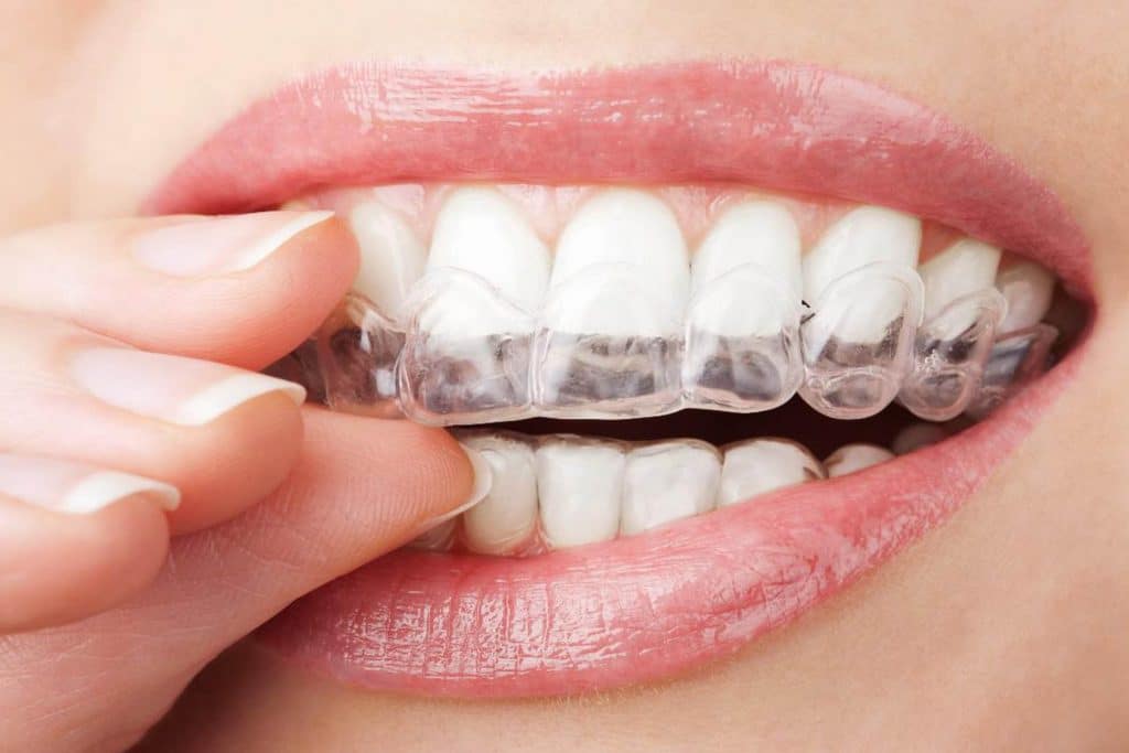 tran_teeth
