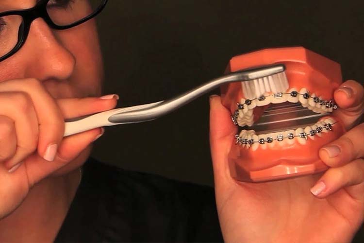 Special Oral Hygiene Aids